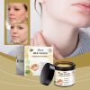 Ximonth Mole And Wart Care Cream, Soft And Smooth Skin Moisturizing And ing Skin Care Cream